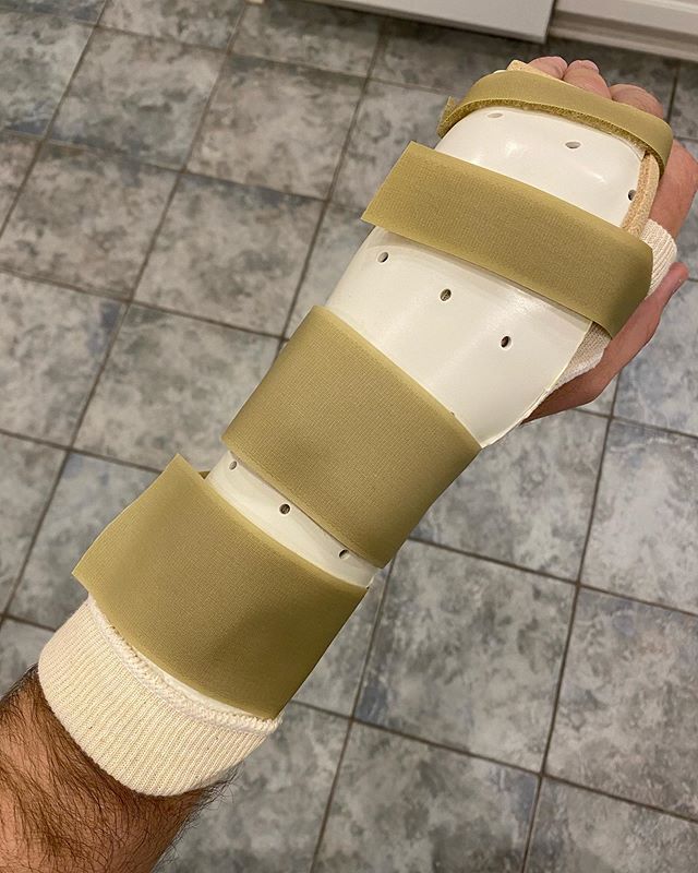 While I was in Israel I took a bad spill in the archaeological remains of the palace of Herod Agrippa II. I knew at the time that I dislocated a finger but found out today that I also fractured my hand in two places and tore a ligament. Will have surgery next Wednesday. #travel #israel